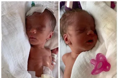 Blizanke Tena i Lena zajedno su imale 3,5 kg kad su se rodile -  danas su zdrave četverogodišnjakinje