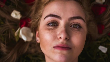 Vodič za hiperpigmentaciju: Za&scaron;to nastaju tamne mrlje i kako ih se rije&scaron;iti