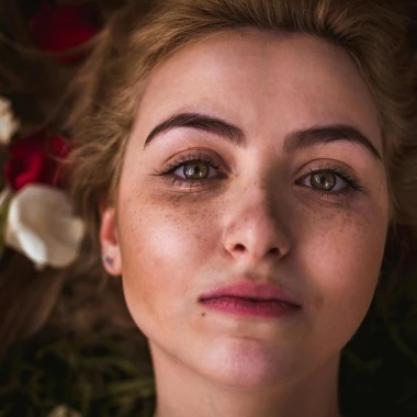 Vodič za hiperpigmentaciju: Za&scaron;to nastaju tamne mrlje i kako ih se rije&scaron;iti