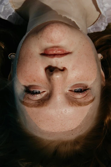 Vodič za hiperpigmentaciju: Za&scaron;to nastaju tamne mrlje i kako ih se rije&scaron;iti