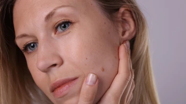 Dermatologinja o čestoj promjeni kože: Evo za&scaron;to se ne smije vjerovati internetu