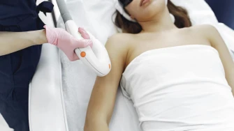 Laserska depilacija: Je li učinkovita, kako se pripremiti i gdje otići na tretman u Zagrebu