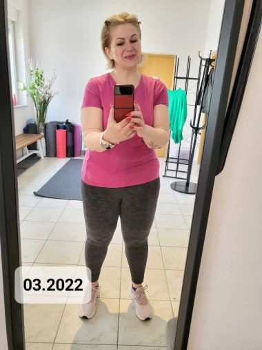 Adela je smr&scaron;avila 50 kg, a onda ju je čekalo jo&scaron; &scaron;est operacija: 'Dignula sam kredit i potro&scaron;ila u&scaron;teđevinu'