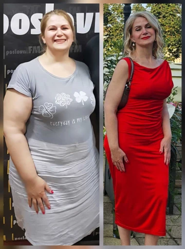 Adela je smr&scaron;avila 50 kg, a onda ju je čekalo jo&scaron; &scaron;est operacija: 'Dignula sam kredit i potro&scaron;ila u&scaron;teđevinu'