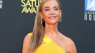 Denise Richards objavila fotografije prije i poslije estetskog zahvata: 'Bila sam prestravljena'